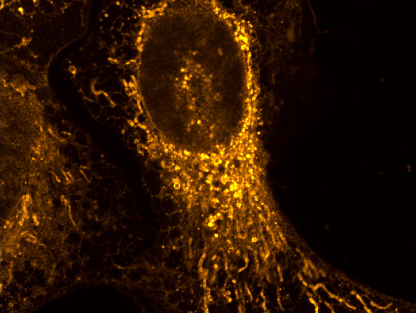 U-2 OS cell loaded with a modified phosphatidylcholine carrying an oleoyl chain. The signal shows where the probe and the metabolic products that retain its functional group have accumulated across the organelles 24 hours after delivery to the plasma membrane.