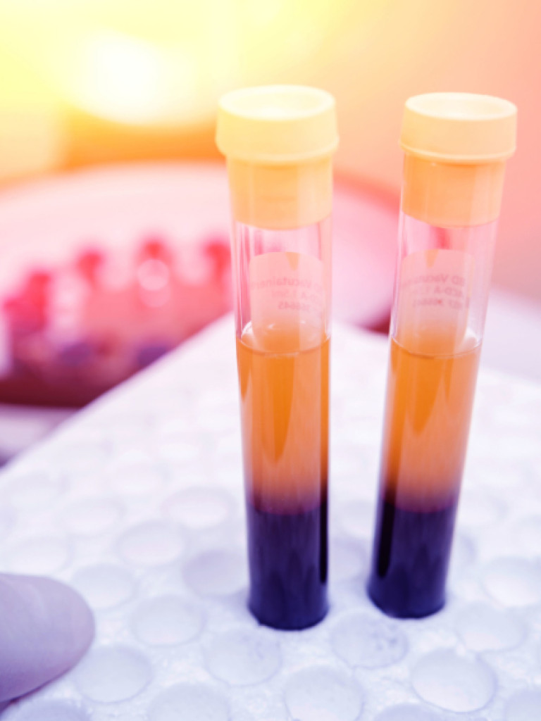 Two test tubes in a stand being held by a hand in a glove. The tube's content has two colors: yellow on top and a darker color at the bottom.  