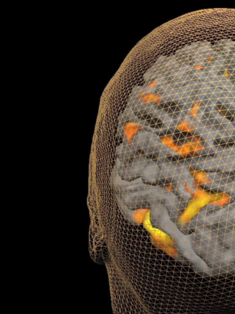 Brain Innovation
