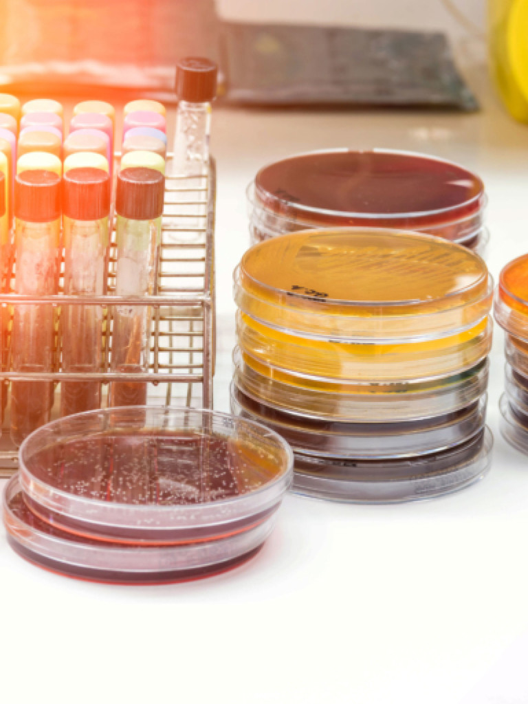 A brightly lit laboratory setting features a rack of test tubes with colorful caps on the left, and several stacks of petri dishes containing various cultured substances on the right. One petri dish is open, revealing a dark, granular substance. The overall impression is one of scientific research and experimentation.