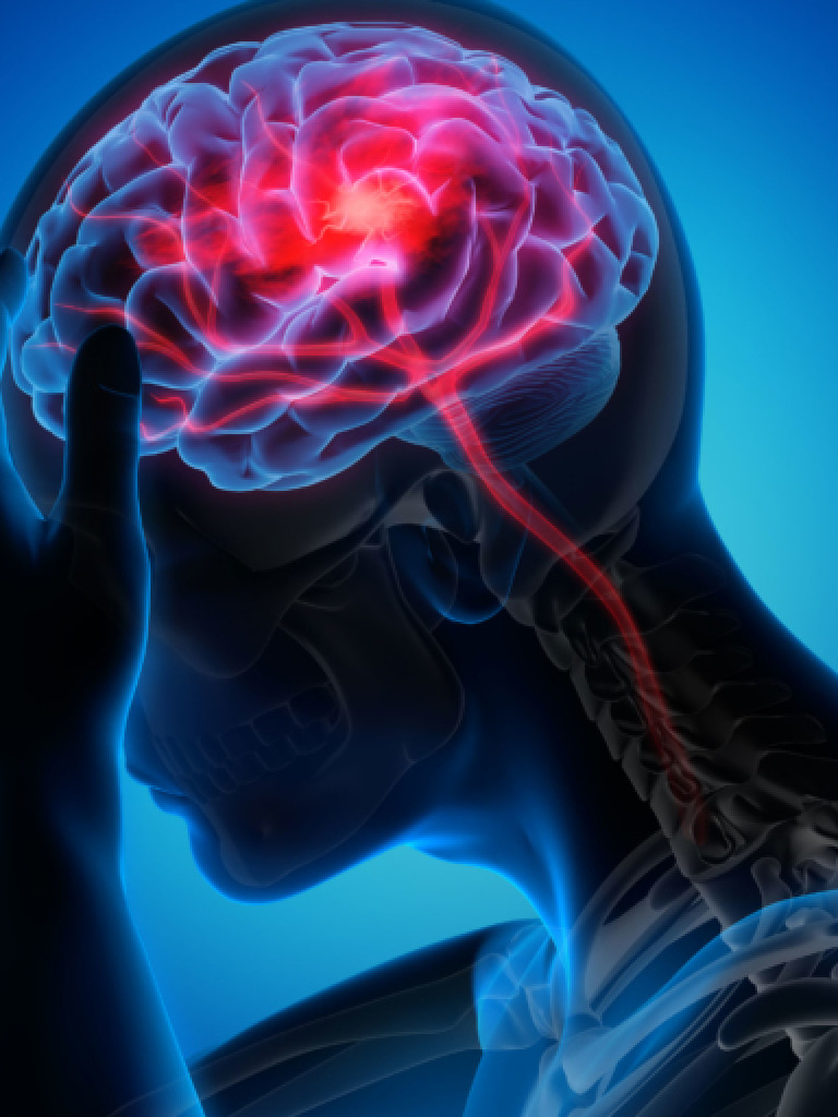 A translucent blue, male appearing human head and upper torso are shown in a side profile against a dark blue background. The skull and skeletal structure of the neck are faintly visible. Inside the head, a human brain is highlighted in bright red and pink, with a particularly intense, glowing red area indicating a focal point of pain or activity, and a red line extending down the spinal cord. One hand is shown grasping the head on the left side, conveying the impression of a headache or neurological issue.