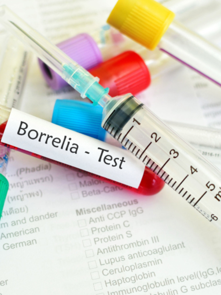 a collection of syringes and sample tubes, one of which is labelled "Borrelia - Test"