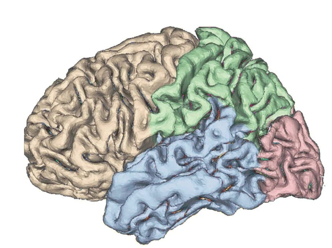 Picture of brain