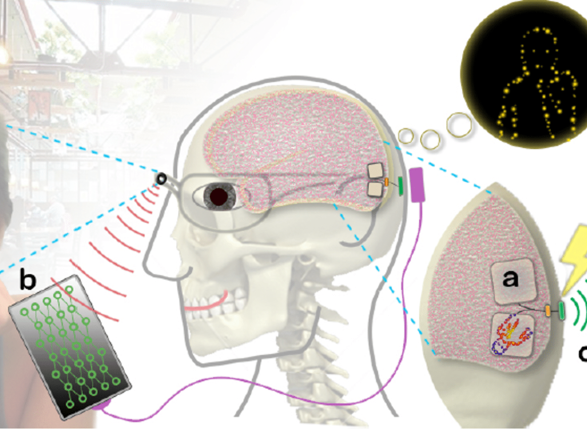 Picture of brain and reaction