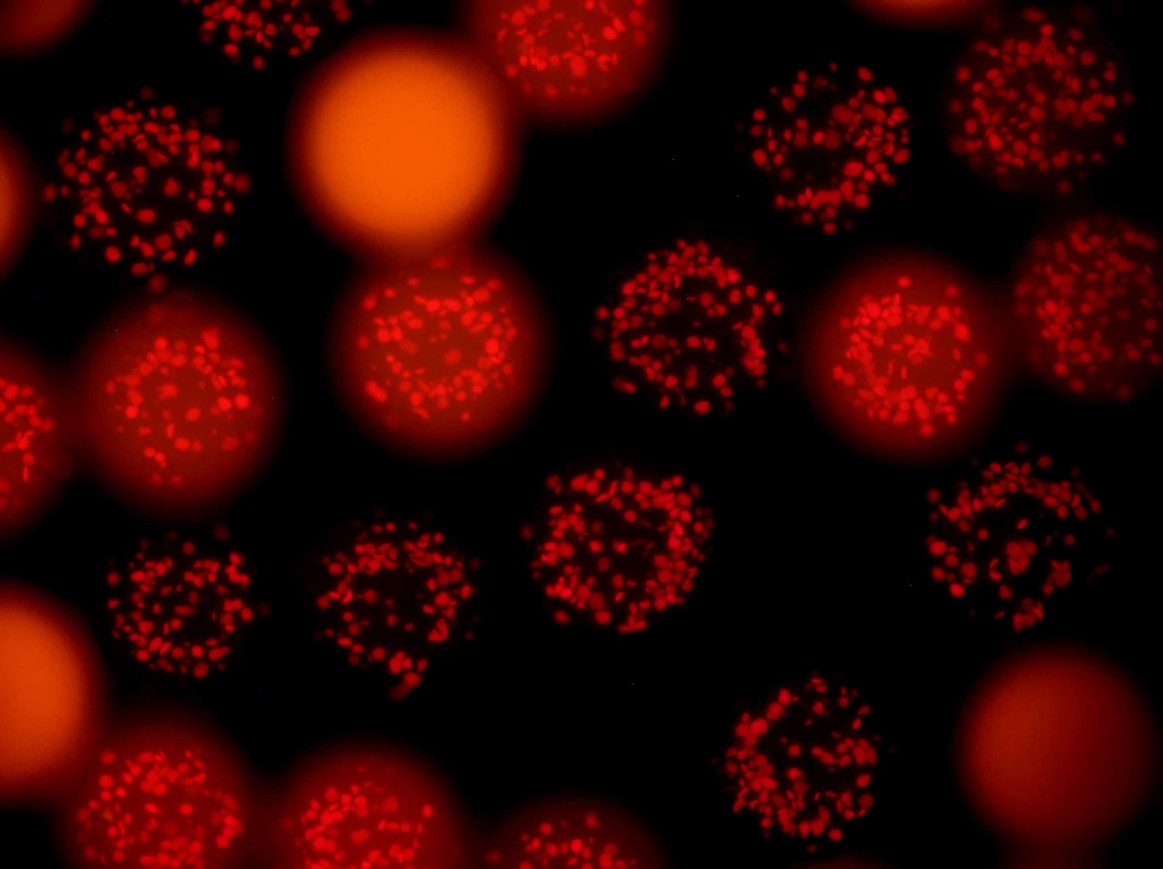 Artificial Cell: MPG / Benoit & Miller